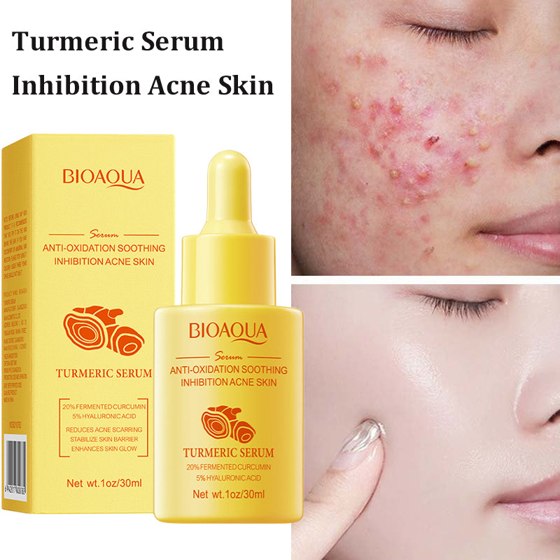 BIOAQUA Turmeric Facial Serum Anti-Oxidation Soothing Acne Skin Hyaluronic Acid Control Oil Moisturizing Face Skin 30ml / 1fl.oz